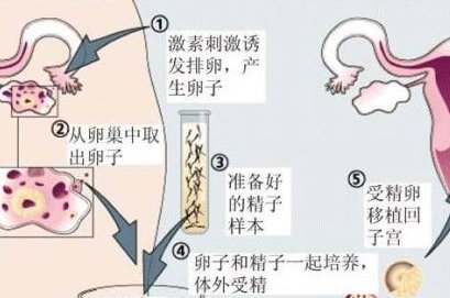 未婚女性可以试管助孕吗？附单身女性的试管生育攻略